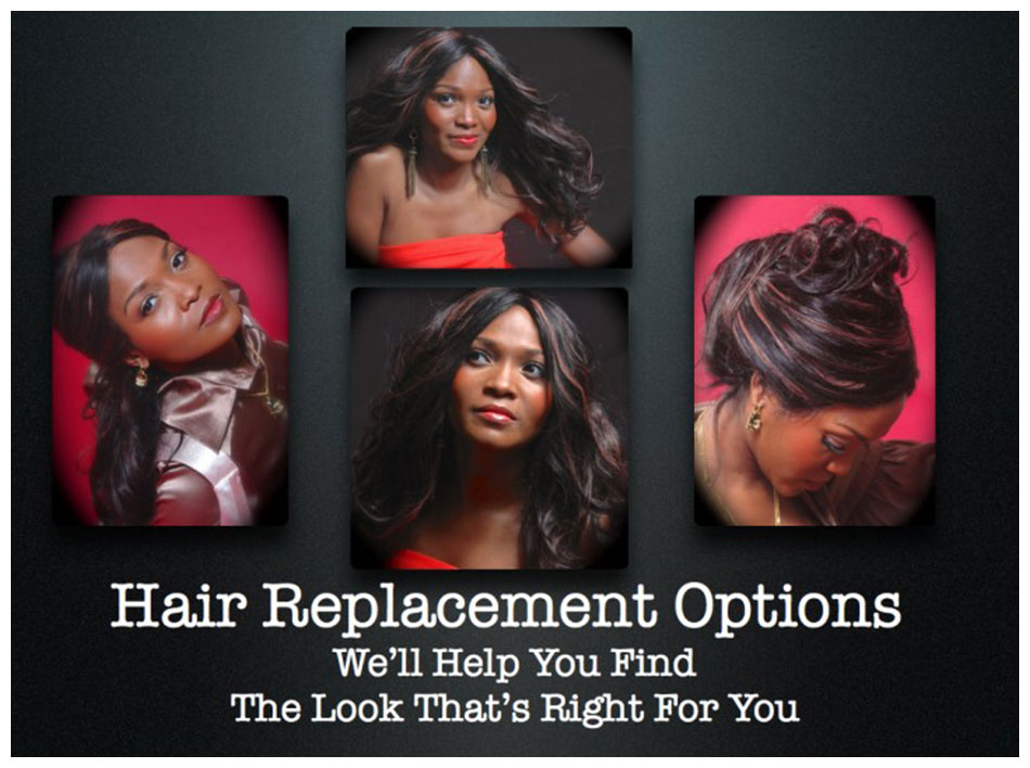 Hair Replacement Options
